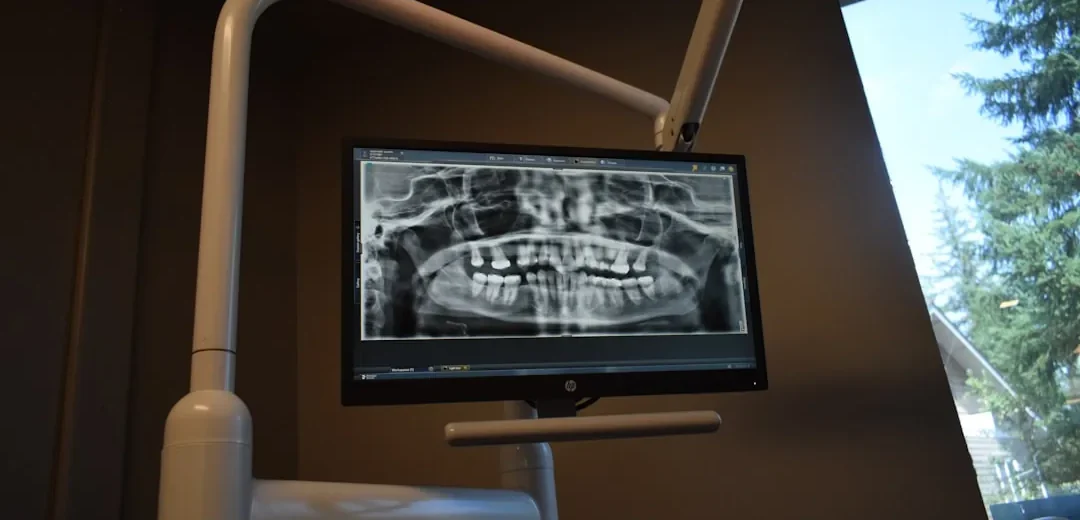 A dental X-ray image