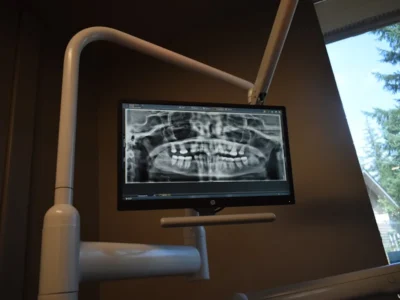 A dental X-ray image
